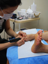 爪や角質のケアの様子